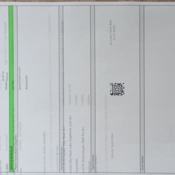 Monster Tulpar T7 19.5 Batarya Şişmesi