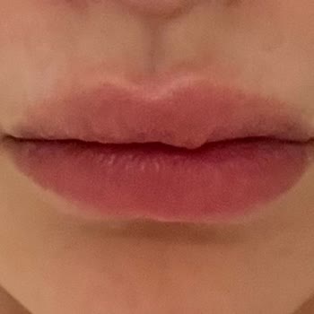 Lami_cosmo Dudaklarımı Mahvetti