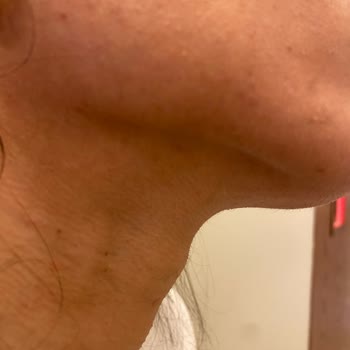 Novar Poliklinik Alsancak Novar Fiyat Politikası Ve Müşteri Olan Kaba Davranışları