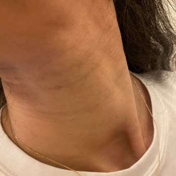 Novar Poliklinik Alsancak Novar Fiyat Politikası Ve Müşteri Olan Kaba Davranışları