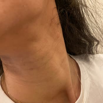 Novar Poliklinik Alsancak Novar Fiyat Politikası Ve Müşteri Olan Kaba Davranışları