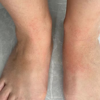 Dermokil Peeling Etkili Ayak Maskesi