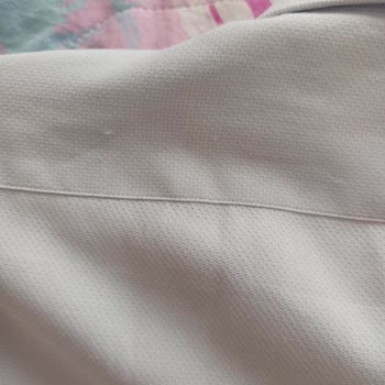 Kiğılı Gömlek Deforme Sorunu Ve Müşteri İlişkileri Yetersizliği