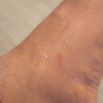 Trendyol Yeni Sezon Crocs Terlikten Beklenmeyen Rahatsızlık