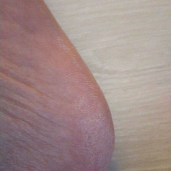 Trendyol Yeni Sezon Crocs Terlikten Beklenmeyen Rahatsızlık