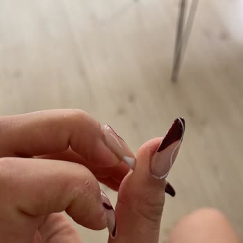 Elvan Abalı Güzellik Merkezi Protez Tırnak Düşmesi