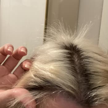 Kuaför Hasan Duman Gebze Saçımı Yaktı Ve Kopardı