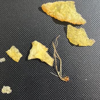 Lays Cips İçinde Saç Çıktı