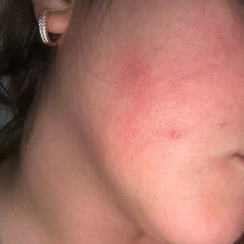 Maruderm Güneş Kremi Cilt Ton Eşitlik