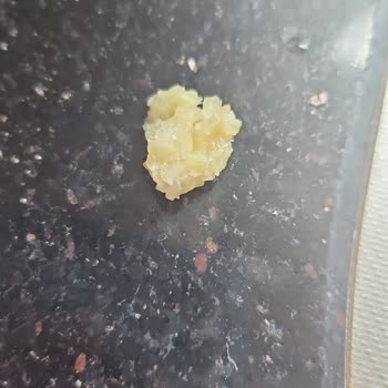 Hizan Karakovan Cevap Vermiyor