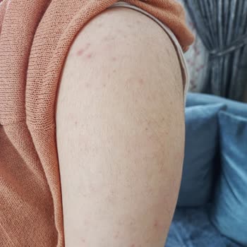 buzlazer.com Üsküdar Masal Güzellik Salonu Şikayet Var.