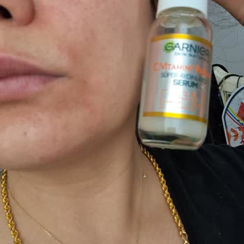 Garnier C Vitamini Serum Yüzümü Yaktı