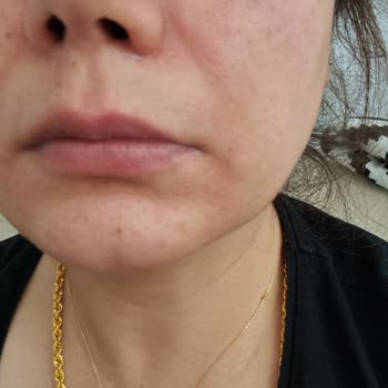 Garnier C Vitamini Serum Yüzümü Yaktı