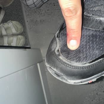 A101 Skechers Ayakkabı Deformesi Ve İnceleme Yapılmaması
