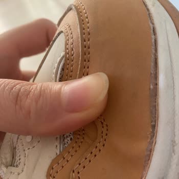 Skechers Ayakkabım 6ayda Açıldı!