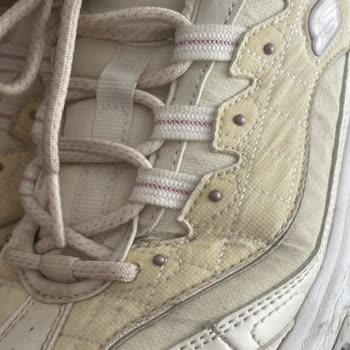 Skechers Ayakkabı Renk Sorunu