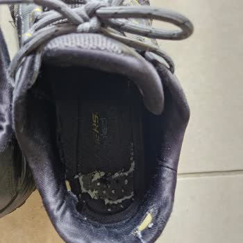 Skechers Ayakkabım Deforme Olmaya Başladı