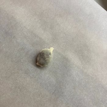 Şampiyon Kokoreç Şampiyon Donmuş Halka Kokoreç