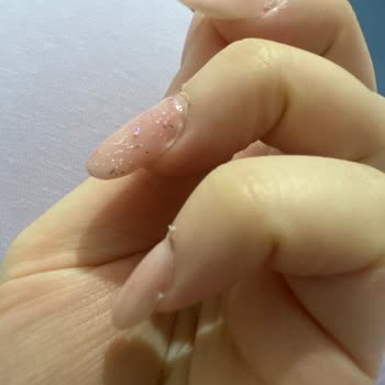 Watsons Tırnak Yapımı Bozulması