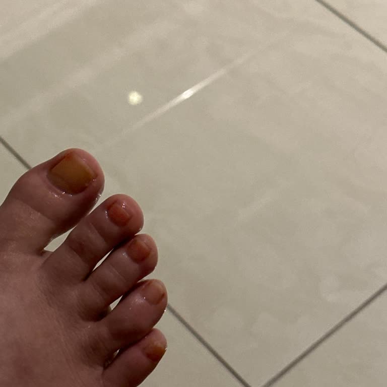 Flormar Oje Tırnak Sorunu