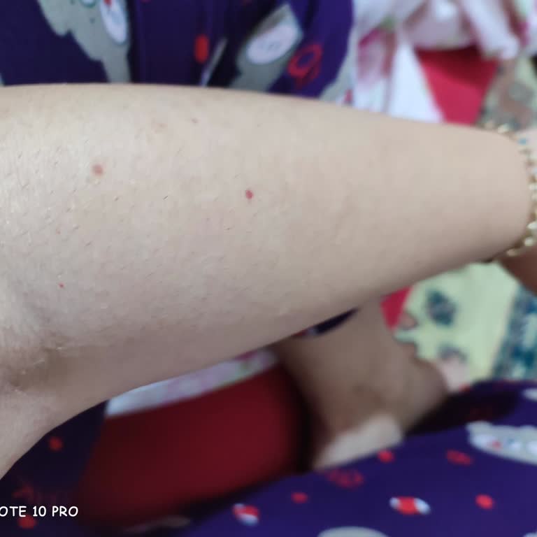 Nihan Ünsal Güzellik & Estetik Lazer Epilasyon Merkezinin İlgisizliği Mağdur Bırakıldım!