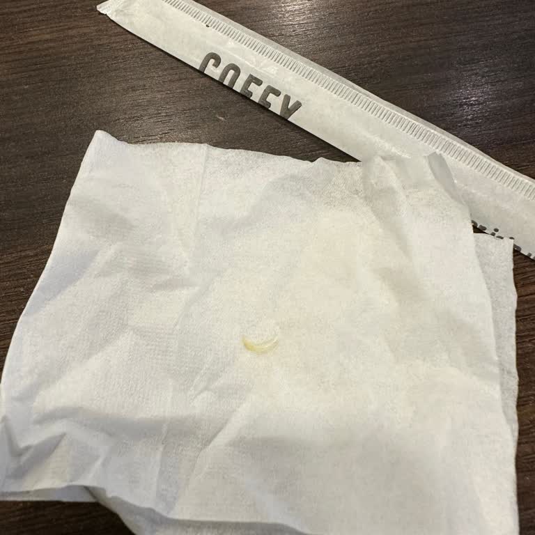 Coffy'de İçeceğimin İçinden Tırnak Çıktı!