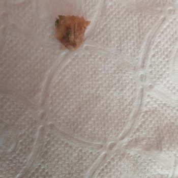 BİM Kemik Dişimi Mi Kırsaydı