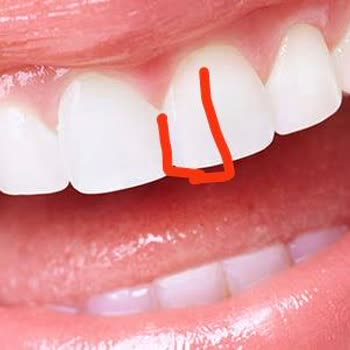 Okan Üniversitesi Diş Hastanesi Yanlış Ve Yarım Tedavi