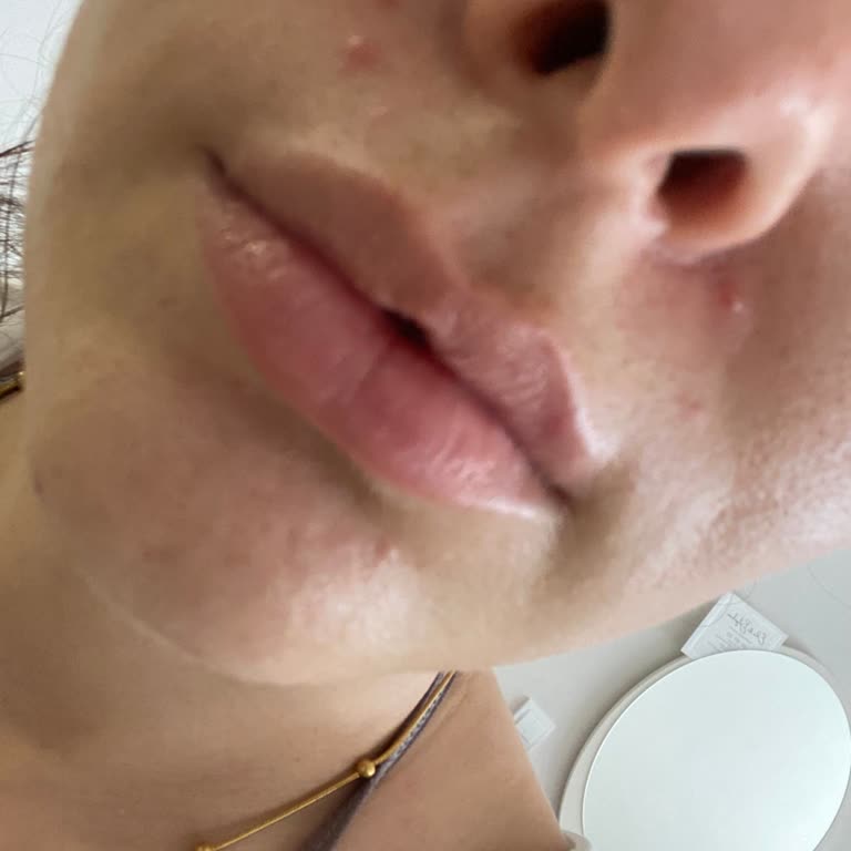 Bioderma Photoderm Güneş Kremi Sivilce Yapıyor