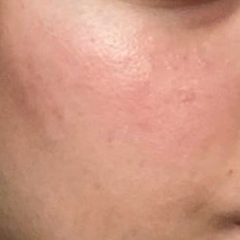 Maruderm Yüz Yıkama Jeli