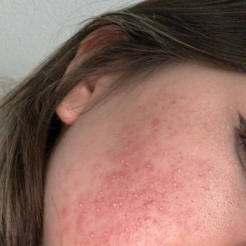 Maruderm Yüz Yıkama Jeli