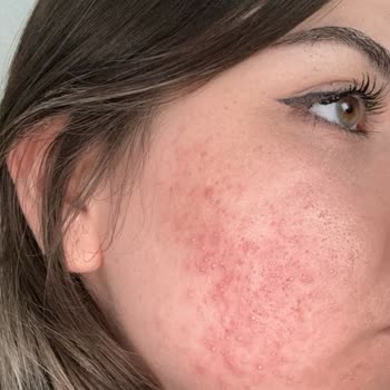 Maruderm Yüz Yıkama Jeli