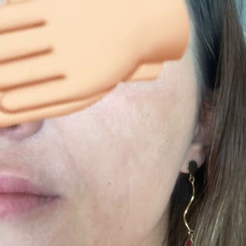 Loreal Paris Cilt Bakımı Sonrası Beklenmedik Tepki!