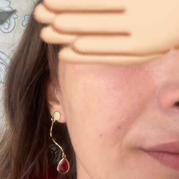Loreal Paris Cilt Bakımı Sonrası Beklenmedik Tepki!