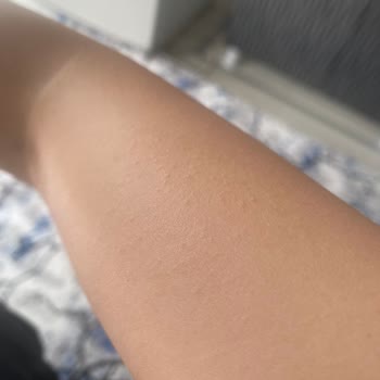 Loreal Paris Cilt Bakımı Sonrası Beklenmedik Tepki!