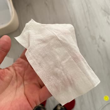 Migros Bozuk Bebek Ürünü!