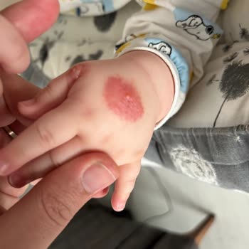 Avcılar Belediyesi Çöp Konteyner Yer Değişikliği