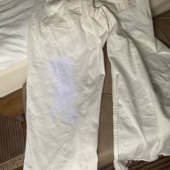 Vanish Kosla Leke Çıkarıcı Değil Tam Tersi Pantolonumu Mahvetti