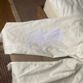 Vanish Kosla Leke Çıkarıcı Değil Tam Tersi Pantolonumu Mahvetti