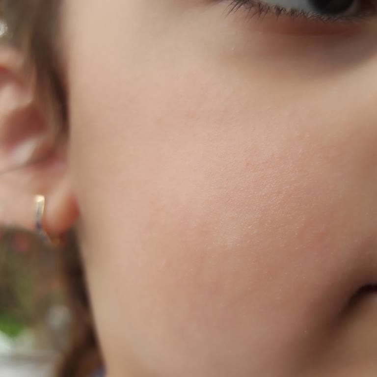 Dr. Öz Klinik Eliamora Kids Güneş Kremi Yan Etkisi