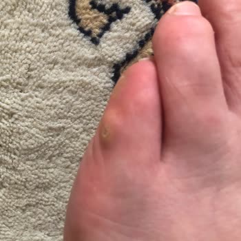 Skechers Gibi Kaliteli Sandığımız Spor Ayakkabının Ayağa Vurması :(