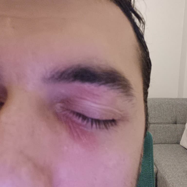 Dalin Egzamayı Tetikliyor Mu?