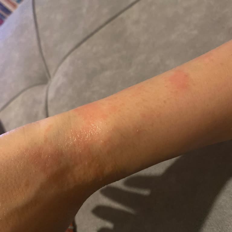 Le Petit Marseillais Duş Jeli Egzama Ve Kaşıntı Yapıyor!