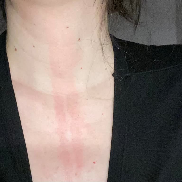 Cosmed Yüz Yıkama Jeli Boynumu Yaktı Kabarttı