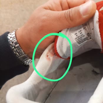 Lacoste Hatalı Ayakkabının Arkasında Durmuyor!