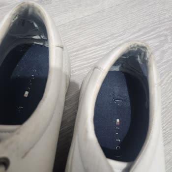 Tommy Hilfiger Shoes Deformity and Denied Warranty Claim