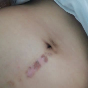 Estistanbul 5 Cm İzle İz Kalacak Derece Yaktı Paramı Yediler!