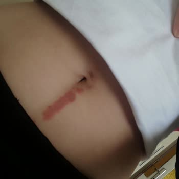 Estistanbul 5 Cm İzle İz Kalacak Derece Yaktı Paramı Yediler!