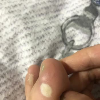 Hopesneakers.tr Orijinal Diyerek Çok Kalitesiz Ayakkabı Sattılar Ayağım Çok Kötü Oldu