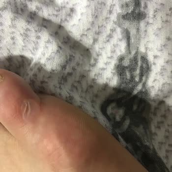 Hopesneakers.tr Orijinal Diyerek Çok Kalitesiz Ayakkabı Sattılar Ayağım Çok Kötü Oldu